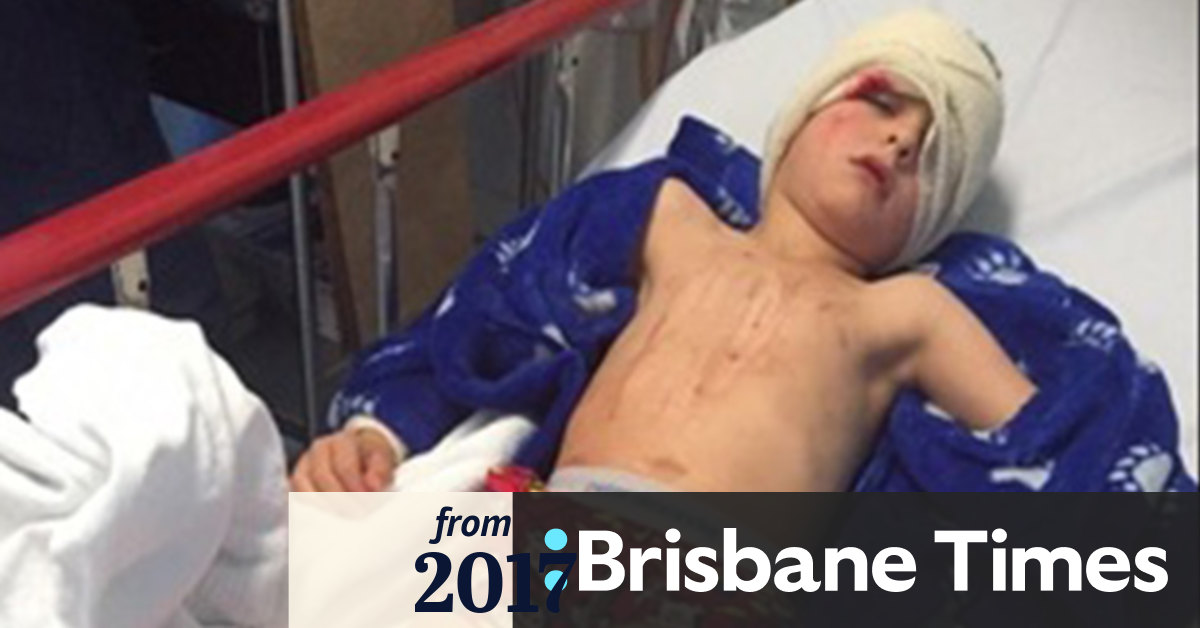 Video Perth boy injured by exploding glass in shower